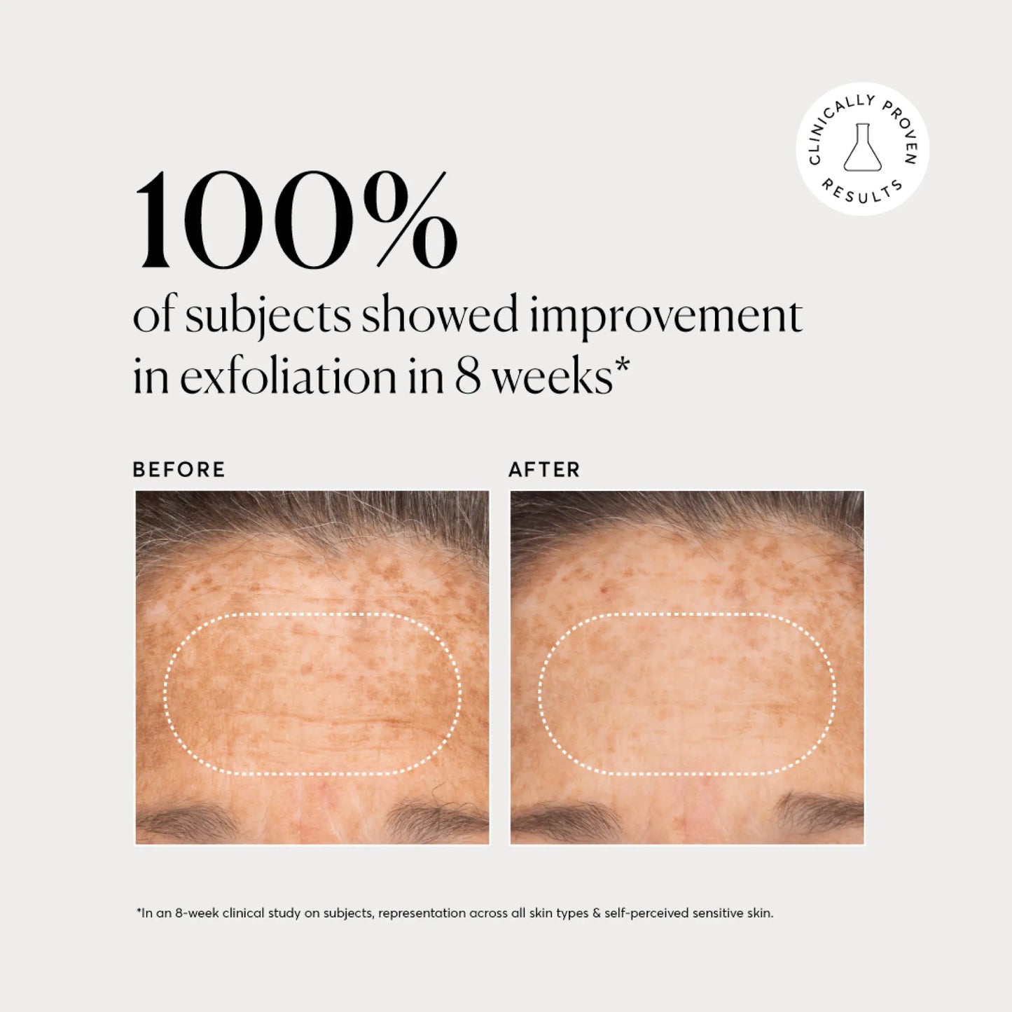 bha-liquid-exfoliant-2-g0 NATR-10027-Alt-Images-BHA-Liquid-Exfoliant-2_-03.webp