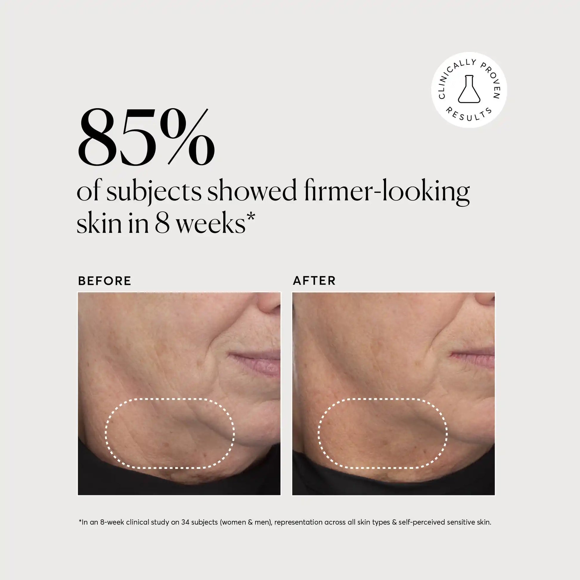 retinol-complex-serum-e4 NATR-10034-Alt-Images-Retinol-Complex-Serum-04.webp
